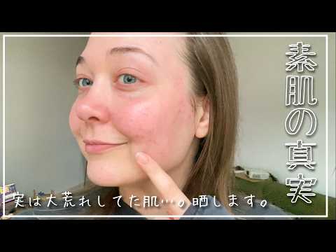 クリスチャン・ドロステンは次のように勧めています: 自分のフェイスマスクを作りましょう - まさにその通りです