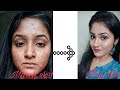2 Months Skin Transformation