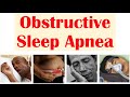 Obstructive Sleep Apnea OSA Risk Factors Signs Symptoms Complications Diagnosis Treatment