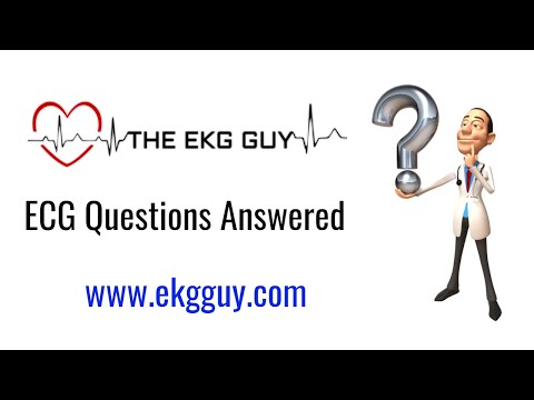 ECG Question Answered | The EKG Guy