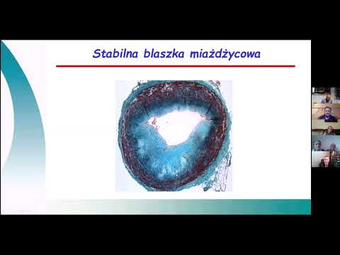 XXIV Spotkanie Krakowskiej Grupy Wsparcia - film 2