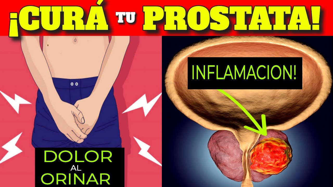 The INCREDIBLE METHODS to REDUCE an ENLARGED PROSTATE! (natural form)