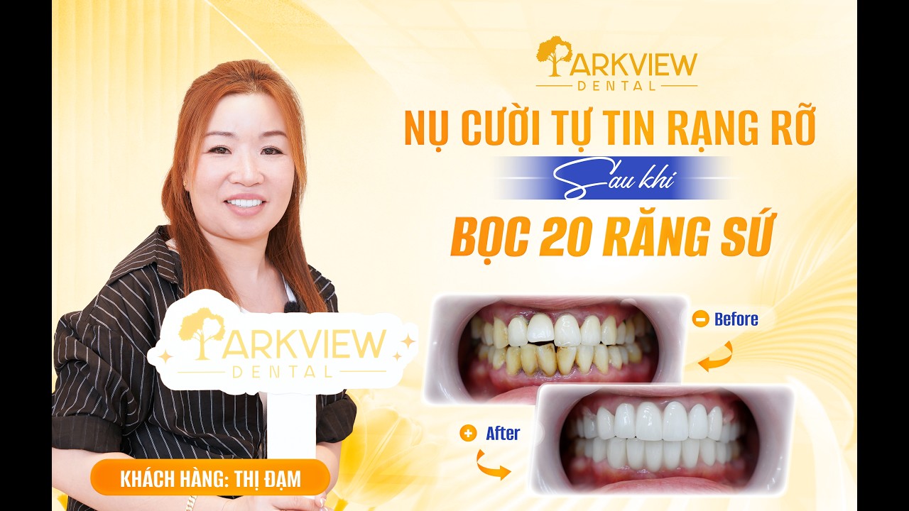 Đau Răng, Sưng Nướu Kéo Dài Và Cái Kết Sau Khi Làm Răng Tại Parkview
