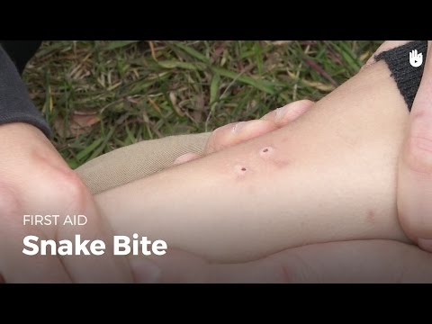 Learn first aid gestures: Snake Bite