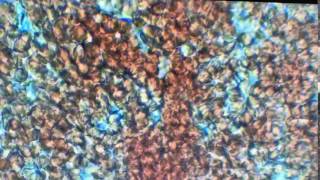 Dirofilaria microscop