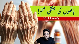 Dr. Zee:#1 Absolute Best Remedy for Dry and Wrinkled Hands उत्तम उपाय