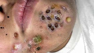 طرق حماية بشرة الوجهCC553