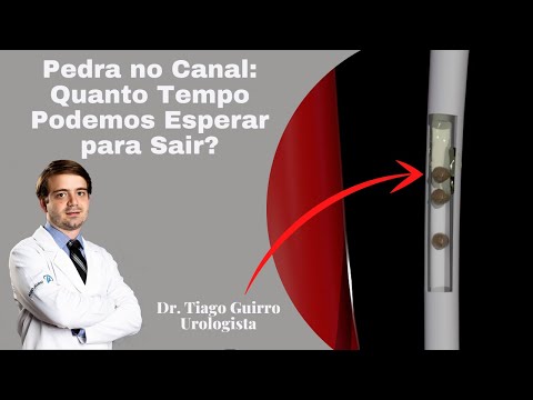 Pedra no Canal: Quanto Tempo Podemos Esperar para Sair?