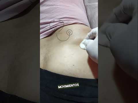 Técnica INTRAMUSCULAR em Z #shorts