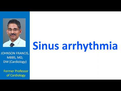 Sinus arrhythmia