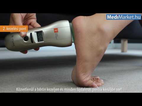 A lábujjak köszvényes izületi gyulladásának kezelése