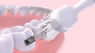 GUM® ORTHO SONIC Toothbrush: Deeper Clean for Braces, Wires & Gum Line