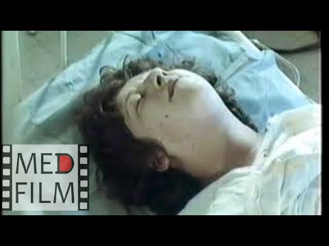 Роды при чистом ягодичном предлежании, проф. Ванина Л.В. © Breech presentation