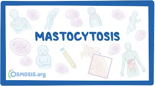 Mastocytosis