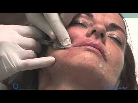 download lagu mp3 mp4 Bios Medicina, download lagu Bios Medicina gratis, unduh video klip Bios Medicina