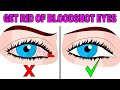 How to Fix Tired & Red Bloodshot Eyes in 5 Easy Steps