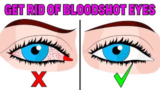 How to Fix Tired & Red Bloodshot Eyes in 5 Easy Steps