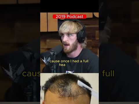 Logan Paul's CRAZY hair loss battle #loganpaul #hairloss #balding