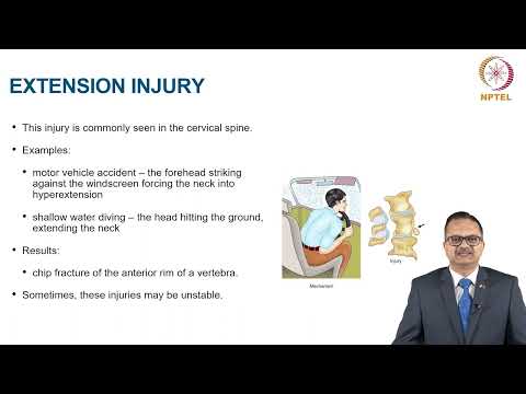 Spine Injuries thumbnail