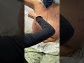 Is Breast Reduction Worth It Absolutely