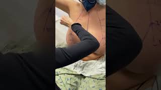 Download lagu Is Breast Reduction Worth It? Absolutely! mp3