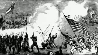 Civil War Life  Shot To Pieces ✪ American History Channel
