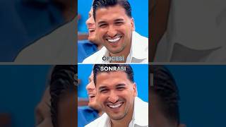 KISMETSE OLUR FATİH'İN DİŞLERİNİ DÜZELTTİM !