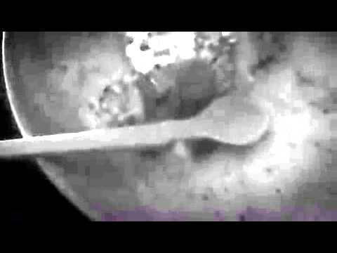 Följ Louise Jacobsson.  / Jacobson