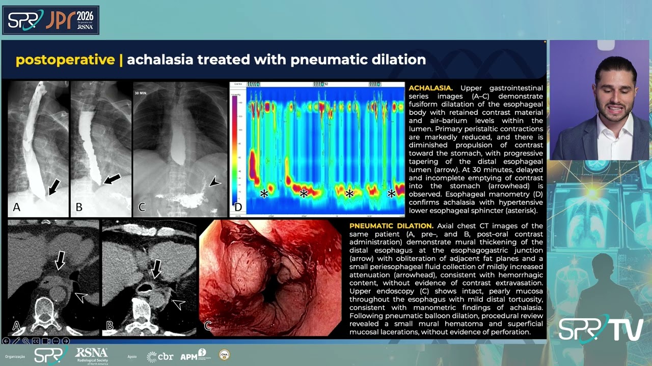 Trabalhos Brasileiros Condecorados no RSNA 2025