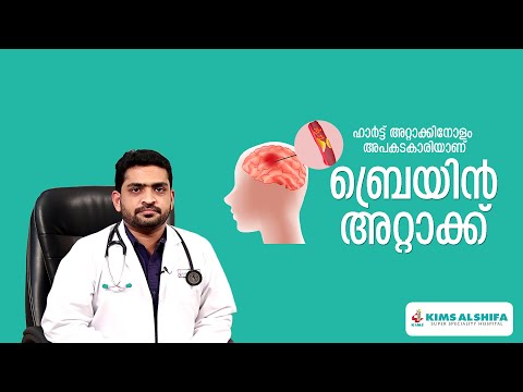ബ്രയിൻ അറ്റാക്ക് വന്നാൽ ഏറ്റവും ആദ്യം ചെയ്യേണ്ടത് | KIMS Alshifa Perinthamanna
