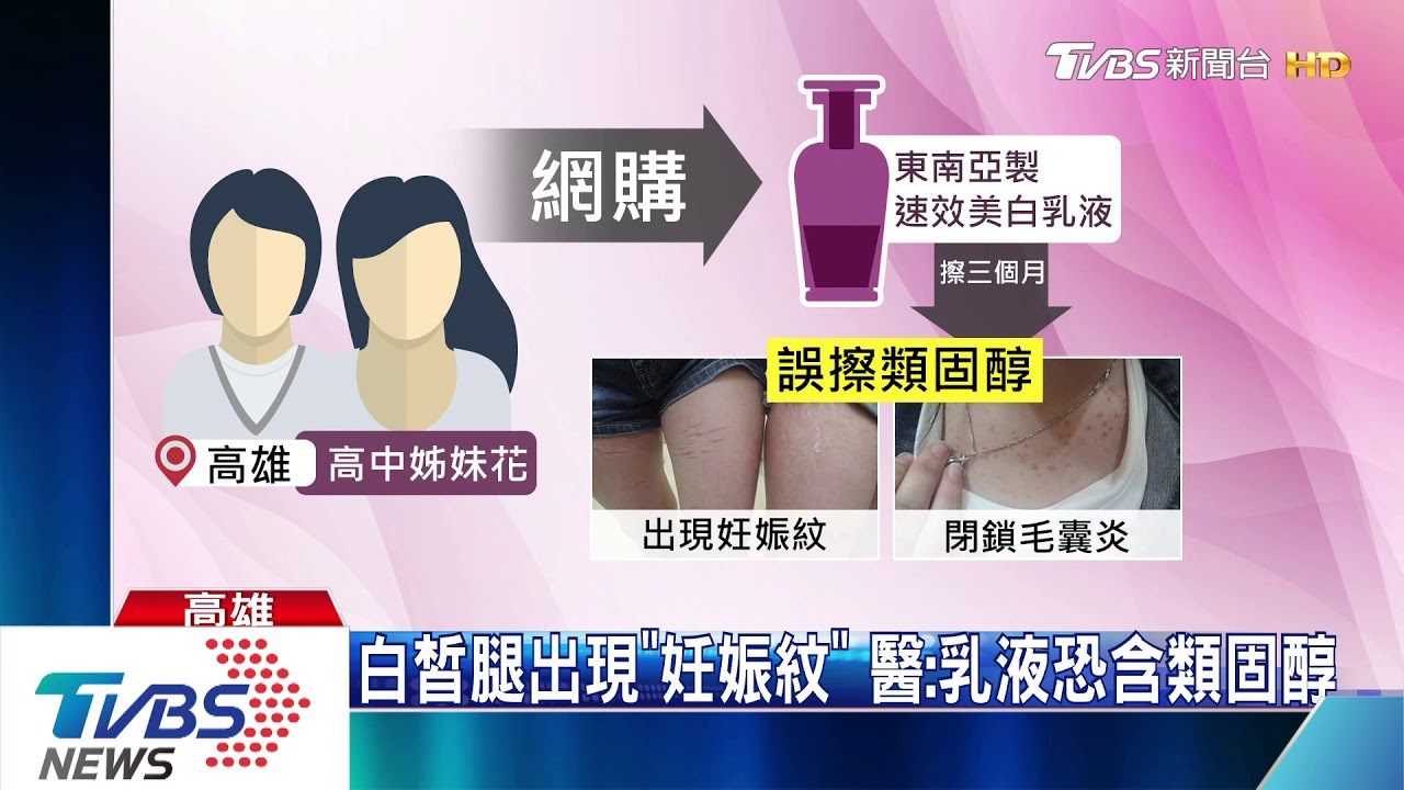 美腿毀了! 擦網購美白霜高中女長「妊娠紋」