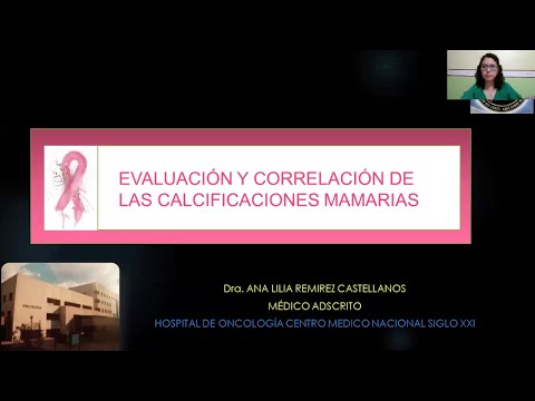 Evaluación y correlación de las calcificaciones mamarias.