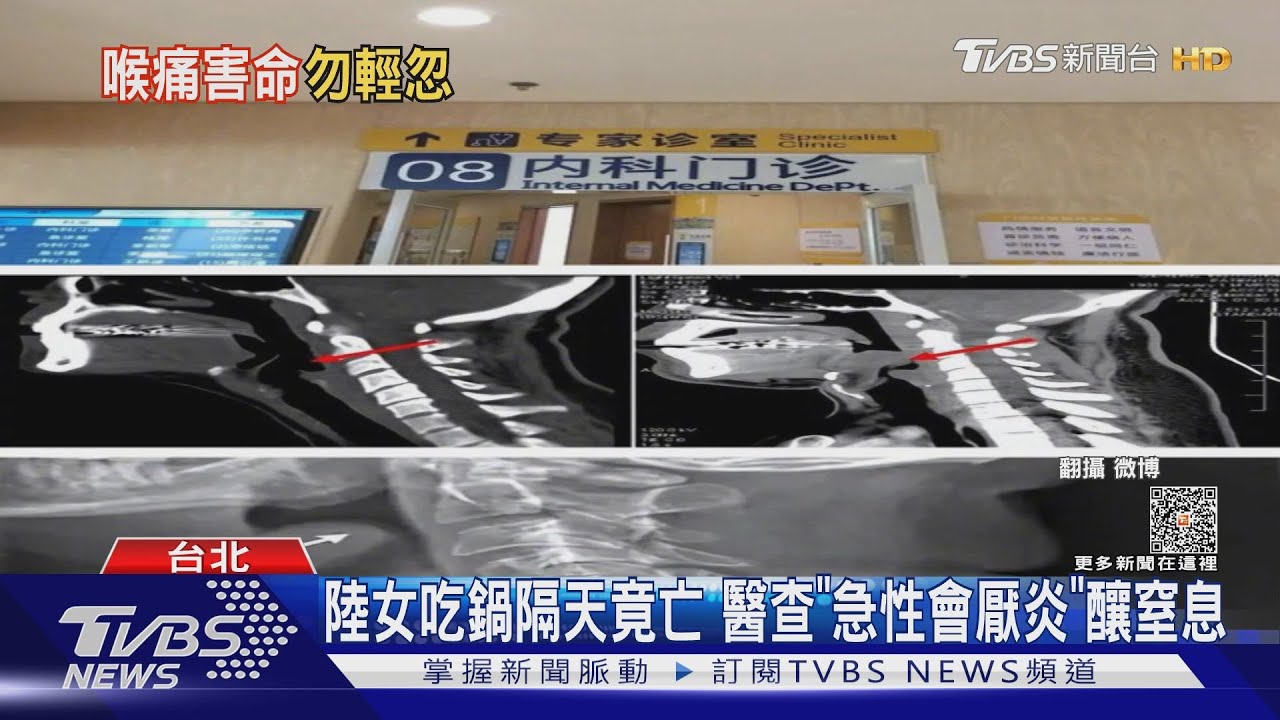 陸女吃鍋隔天竟亡 醫查「急性會厭炎」釀窒息