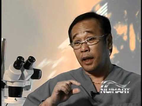 Nu/Hart Hair Transplantation with Dr. Romeo Bato (Manila)