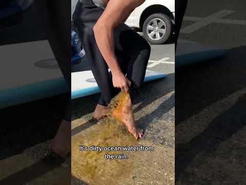 Is There Pee in the Leg of My Wetsuit?