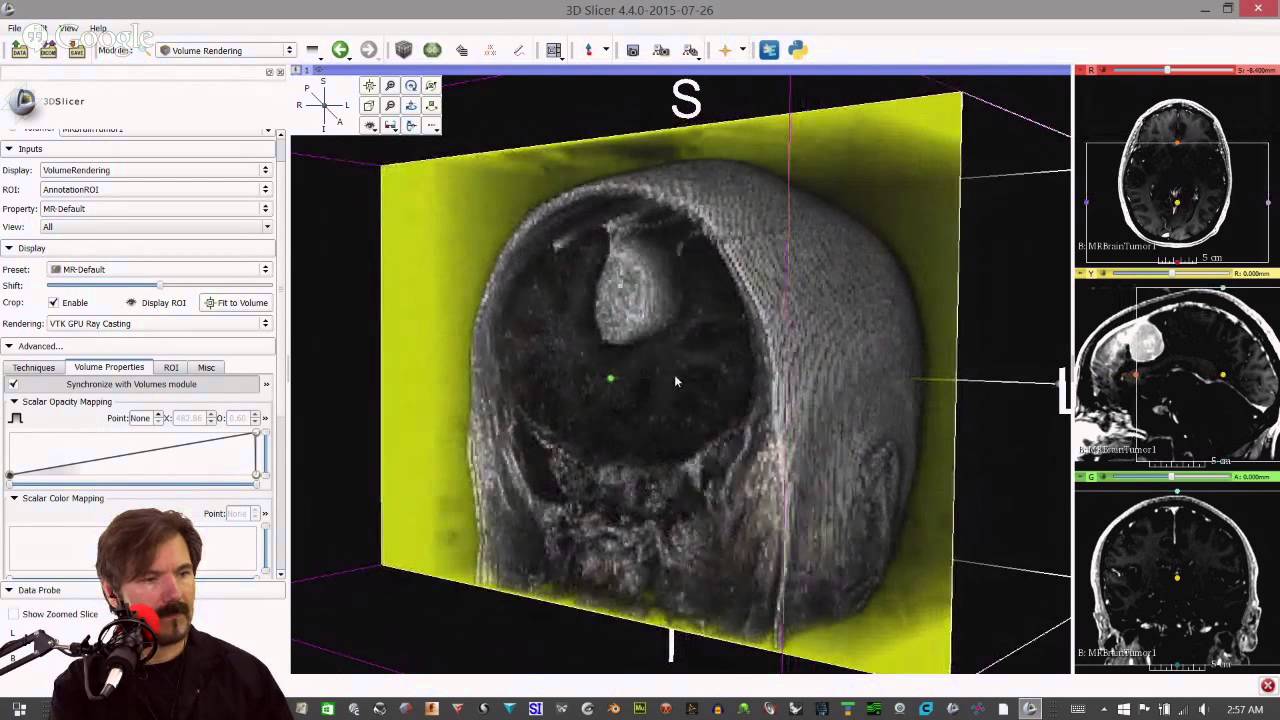 Learn to turn your CAT (CT) or MRI scan into a 3D model.