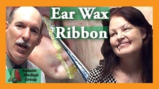 LONGEST Ear Wax Ribbon | Auburn Medical Group