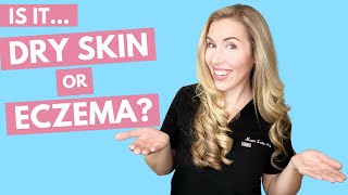 Is it Dry Skin or Eczema? | How to Treat With Affordable Product Recommendations!