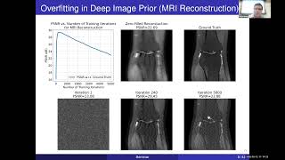 Download the video "ADVANCING IMAGE RECONSTRUCTION AND RESTORATION THROUGH ROBUST SUPERVISED AND GENERATIVE MODELS"