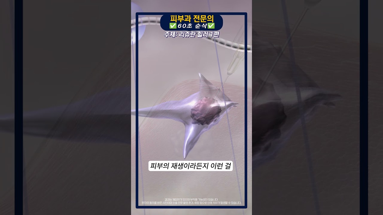 땡큐성형외과 Clips