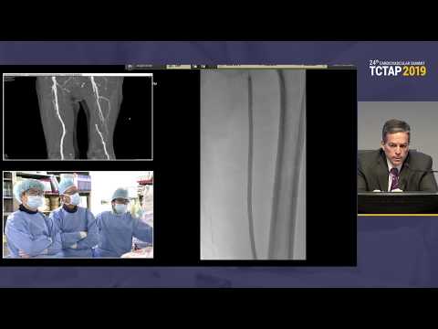 [TCTAP 2019] Endovascular Symposium - Live Case Session I