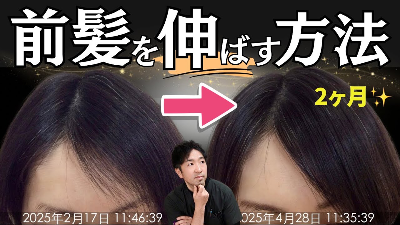 【薬なし】43歳女性が前髪を伸ばした方法。食事5つのポイント&注意点