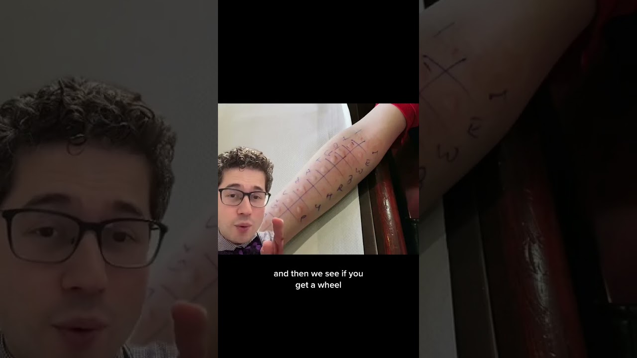 Allergic to needles!? #allergies #testing #doctor