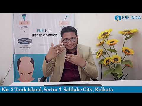 Hair Transplant Result Video 1