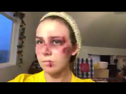 Beaten and Bruised Timelapse