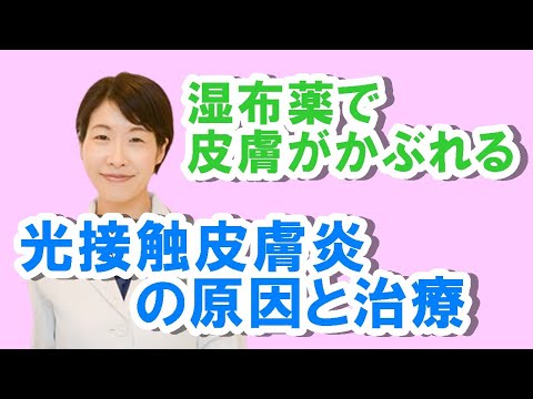 接触皮膚炎について詳しく解説