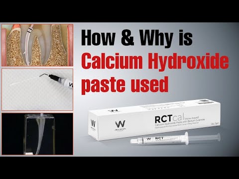 How & Why is Calcium Hydroxide paste used | Waldent RCTcal
