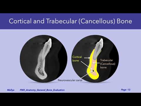 General Evaluation of Trabecular Bone | Dental Radiology