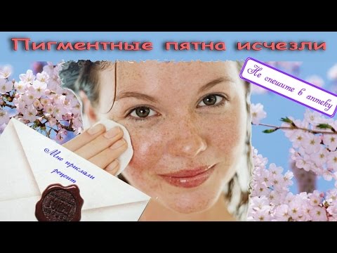 Веснушки на ножках у ребенка Маски из глины для лица от пигментных пятен на