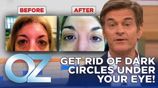 How to Get Rid of Dark Circles Under Your Eyes | Oz Beauty & Skincare